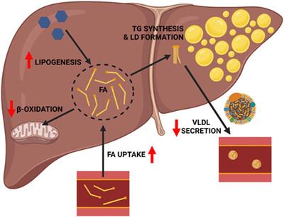 Pathogenesis of Alcohol-Associated Fatty Liver: Lessons From Transgenic Mice